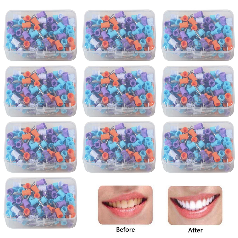 Dental Rubber Polishing Prophylaxis Cups Cup Teeth Prophy Polisher colorful FA - Image 2 of 4