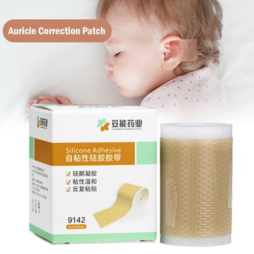 Silicone Baby Ear Corrector Infant Protruding Ears Correction 4 x 50cm For .yu
