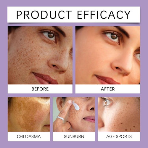 EPIGLOW MelanEX Advanced Anti-HyperpigmentationCream - Picture 11 of 13