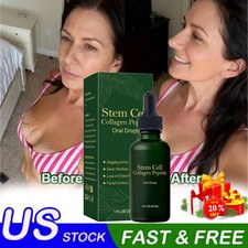 Stem Cell Collagen Peptide Oral Drops Firm Sagging Skin Reduce Wrinkle 30ml
