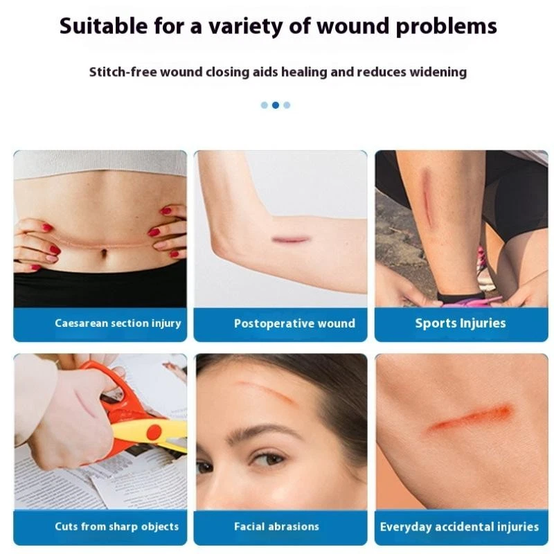 Lot de 15 Sifflets de Survie D'urgence avec Porte-clés pour Sifflets de