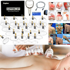 Ventosas De Acupuntura 24 Pcs Set Chinas Para Terapia Masajes Celulitis Masaje