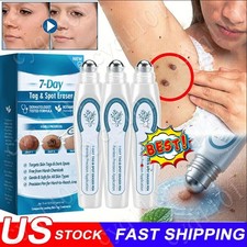 5X Tag Spot Eraser Mole Skin Tags Removal Tool Eraser Pen Painless Long-Lasting