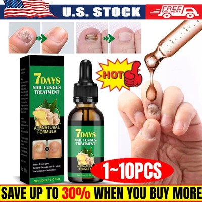 1~10x Ginger Nail-Treatment Nail-Care, Nail-Growth Oil for Cuticle Nourishment ~