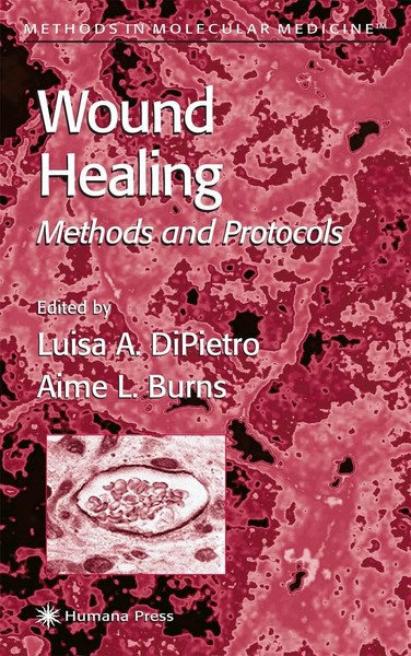Wound Healing Methods And Protocols Luisa A. Dipietro (U. A.) Taschenbuch Xvi-image