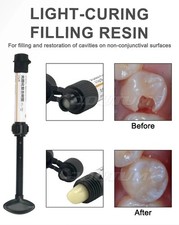 Dental Cement Teeth Resin Tooth Repair Gap Cavity Filling Strong Tooth Repair