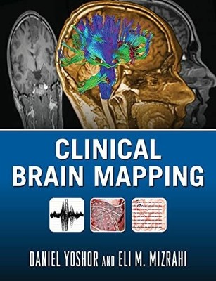 Clinical Brain Mapping (Medicina) Buch McGraw-Hill Medical