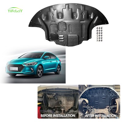 For Hyundai Elantra 2017-2020  Heavy-duty Engine Shield Skid Plate Engine Cover