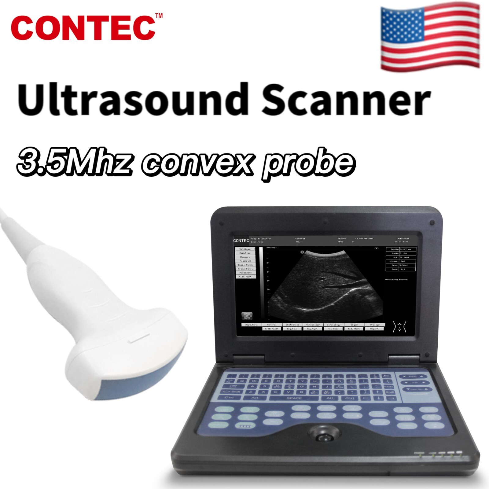 CONTEC CMS600P2 Digital Ultrasound Scanner Laptop Machine 3.5Mhz Convex Probe US