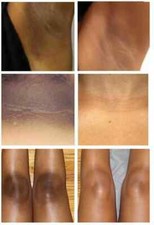 Skin Lightening Cream Glowing Youthful Skin Unisex All Skin Type 15gm FREESHIP