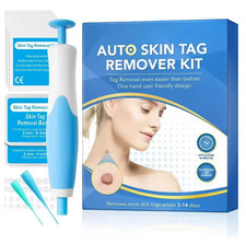Auto Micro Skin Tag Remover Device Kit Safe Painless Removal 2-8 mm Band Tool