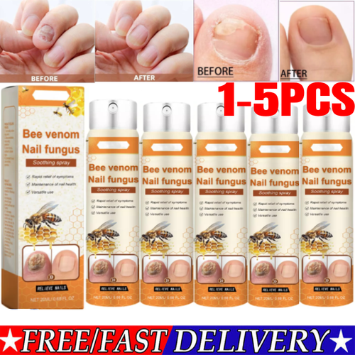 Spray calmante de uñas veneno de abeja para uñas de los pies, spray calmante de hongos de uñas veneno de abeja ~