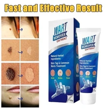 Wart Remover Fast Acting Gel Wart Remover Freeze Off - Fast-Acting 100gm