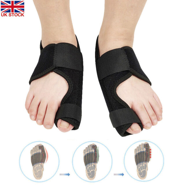 Pedimend Orthopedic Bunion Splints Big Toe Straightener for Hallux Valgus - UK Pedimend Orthopedic Bunion Splints Big Toe Straightener for Hallux Valgus - UK