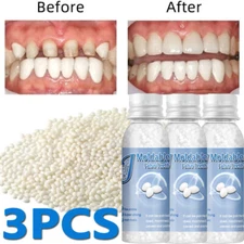 Tooth Repair Kit For Broken Teeth Tooth Repair Granules Temporary Tooth Repair