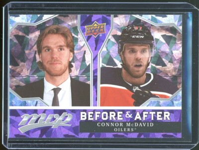 2021-22 Upper Deck MVP Before & After Complete Insert Card Set #BA1-20 