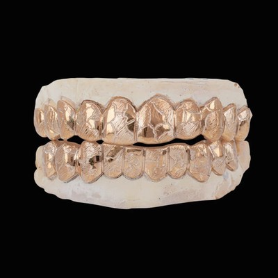 Custom Nugget Style Design Outline Gold Grillz