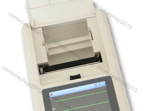 CE 1 Channel ECG Electrocardiograph 12 Lead EKG USB PC Software Touch Digital - Picture 9 of 12