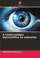 A Biotecnologia Desmistifica As Cataratas Abdelhafid Mimouni Taschenbuch 2025