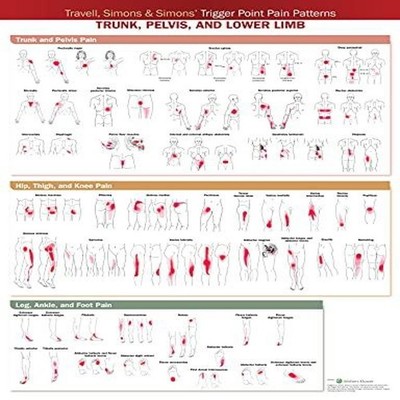 Travell Simons Simons' Trigger Point Pain Patterns Wall Chart Tru