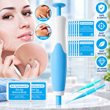 Auto Micro Skin Tag Remover Device Kit Safe Painless Removal 2-8 mm Band Tool