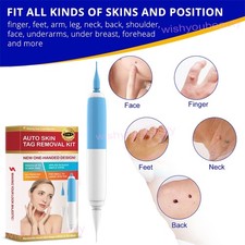 Skin Tag Remover Pen 2 in 1 Micro Painless Wart Removal Tool Kit