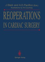 Jarda Stark (U. A.) | Reoperations In Cardiac Surgery | Taschenbuch | Englisch