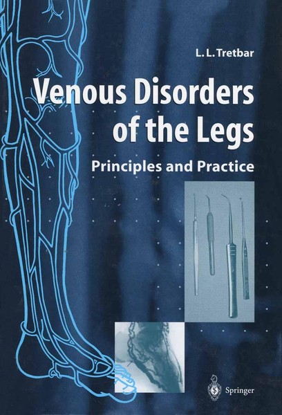 Venous Disorders Of The Legs Lawrence L. Tretbar-image