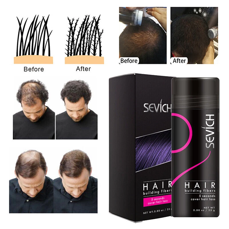 Sevich Hair Building Fibres Thickening Fibers Refill Hair Fibers Keratin Thicken - image 2 of 4