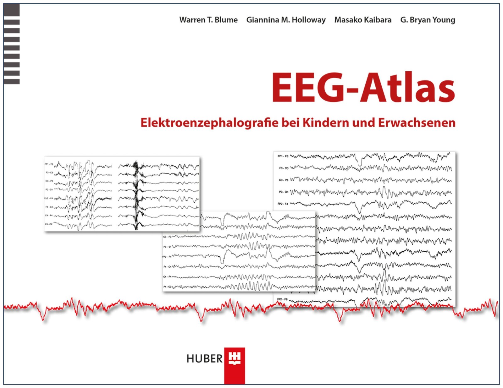 EEG-Atlas Warren T. Blume