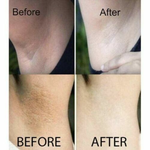 1x Nuwhite H6 BRIGHTENING SKIN CREAM DARK SPOT 5ml - Bild 7 von 7