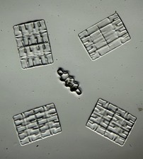 Antique microscope slide. Diatoms. Terpsinoe musica. Houston, Texas.