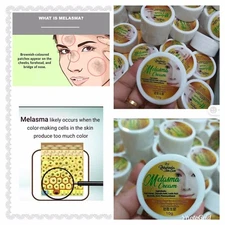 Melasma Cream Remove Dark Acne Sun Spot Melasma Hyperpigmentation Best Seller