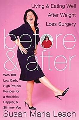 Before and After : Living and Eating Well after Weight Loss Surge
