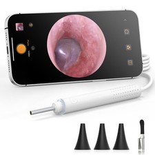 Otoscope with Light, 720P HD Ear Cleaning Camera  6 LED Lights Ear Scope, Di...