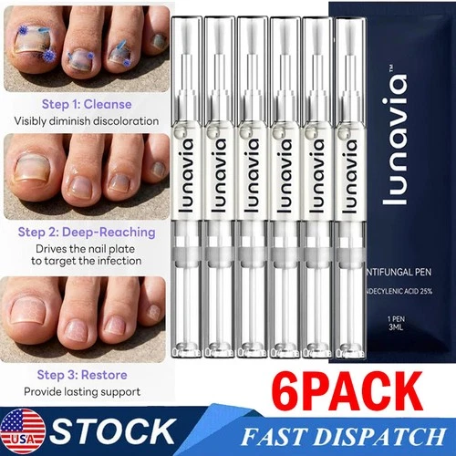 6 Pack Lunavia Antifungal Pen, 25% Undecylenic Acid – Toenail Fungus Treatment