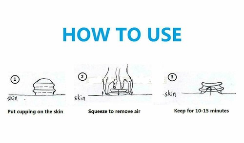 5 Cups Cupping Therapy Set Vacuum Suction Machine Kit Massage Body Acupuncture - Picture 10 of 10