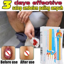 Nature Hemorrhoids Remove Ointment Herbal Cream Relief Piles Pain Reduce Itching