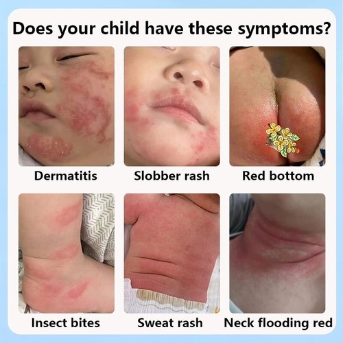COMBIDERM CREAM FOR BABY & ADULT - Picture 4 of 7