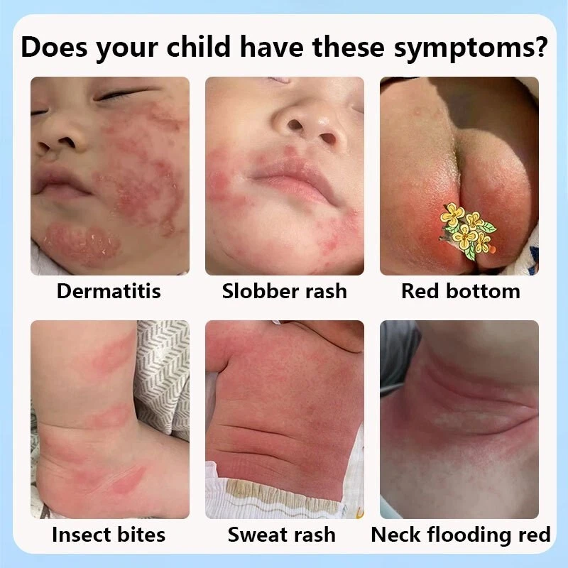 COMBIDERM CREAM FOR BABY & ADULT - Image 4 of 4