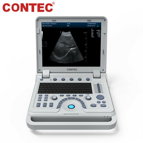 Portable Laptop Machine Digital Ultrasound Scanner Pulse Spectrum Doppler Convex - Picture 10 of 10