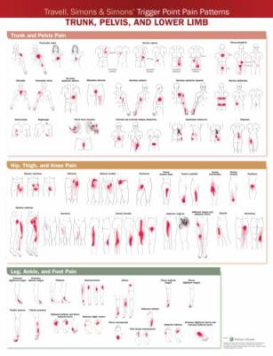 Travell, Simons & Simons Trigger Point Pain Patterns Wall Chart : Trunk, Pelv...