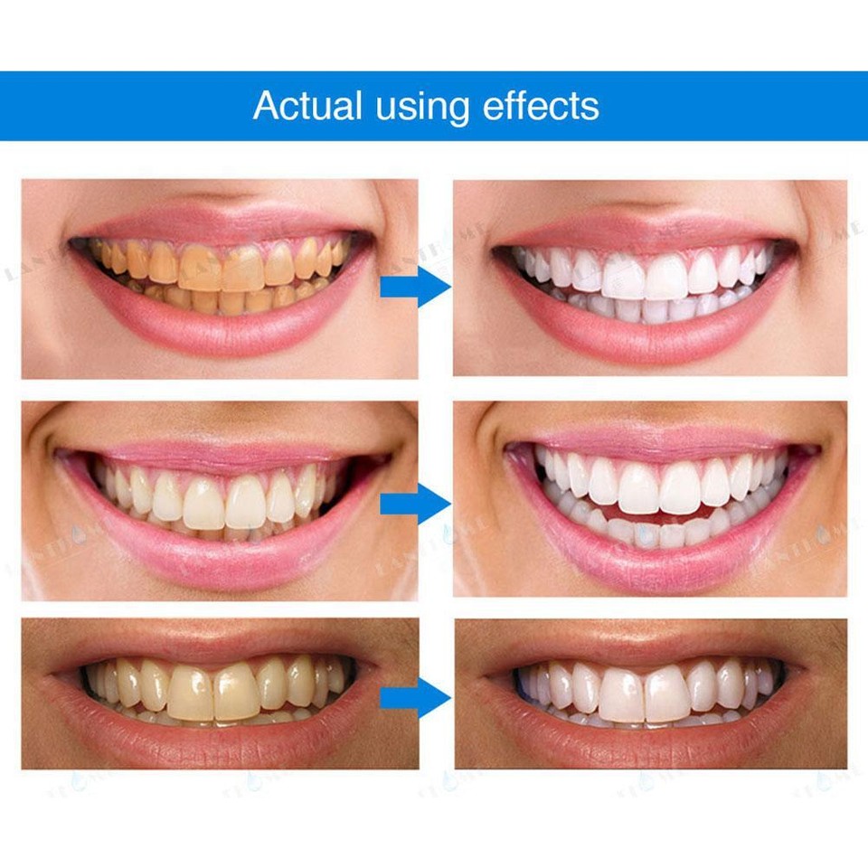 Teeth Whitening Pen Essence Teeth Whitening Brush Teeth Whitening Liqu