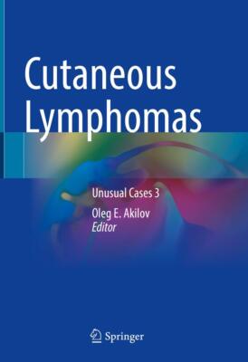 Cutaneous Lymphomas: Unusual Cases 3 by OlegE Akilov (hardcover)