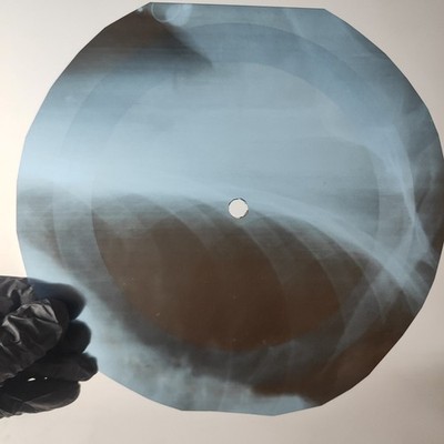 DAVID BOWIE THERE IS A HAPPY LA X-Ray USSR Record Roentgen Bone Ribs Music Vinyl