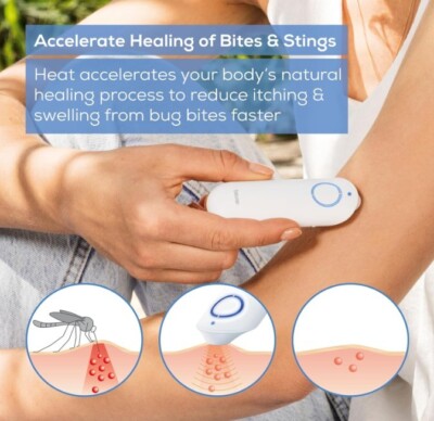 Beurer BR60 Insect Sting&Bite Relief-Bug Bite Healer for Chemical-Free Treatment