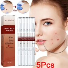 5X Common and Plantar Moles-Off Wartsoff Remover, WipeOff Tags Moles Remover NEW