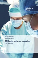 Naqoosh Haidry (U. A.) | Tmj Ankylosis- An Overview | Taschenbuch | Englisch