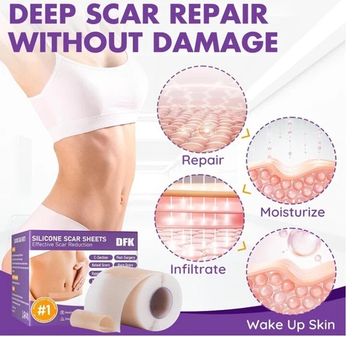 Silicone Scar Sheets & Tape Roll (3M) | Scar Removal, Keloid,Surgery, Acne,Marks - Picture 3 of 4