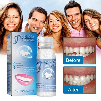 1x Resin False Teeth Solid Glue Temporary Tooth Repair Moldable Teeth Gap Filler